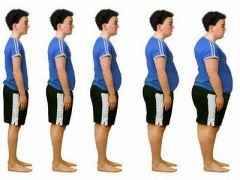 Obesidade na adolescência aumenta risco de câncer no intestino, diz estudo