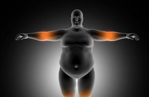 Dia mundial da saúde: o que você precisa saber sobre a obesidade